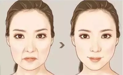 这就是一个本不起眼的法令纹
