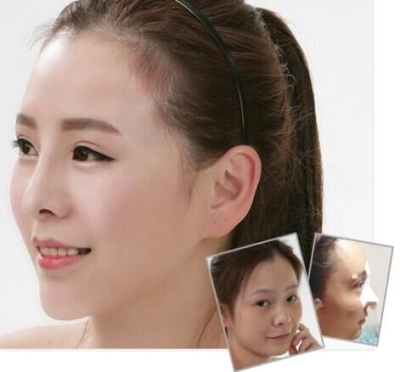 整形, 如何选择到一位好的?