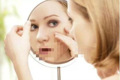 【北京艺星】色斑是如何形成的?你对色斑的了解有多少