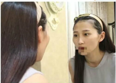 北京艺星做隆鼻哪家好?从邻家小妹变女神!带你看看魔镜