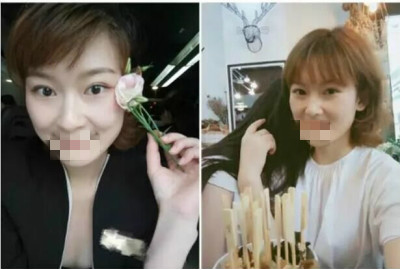 北京做皮秒激光哪里好?闺蜜素到“无妆”靓爆镜