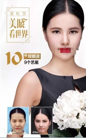 北京做双眼皮哪里做的好?谈谈变美小技巧