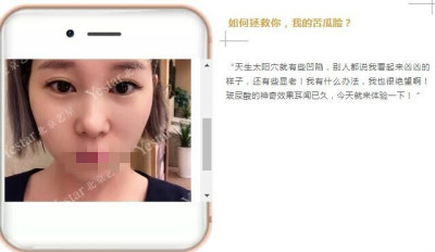 北京玻尿酸哪家医院好?变美不是靠运气