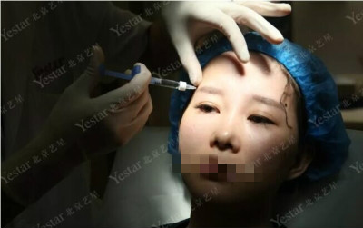 北京玻尿酸哪家医院好?变美不是靠运气