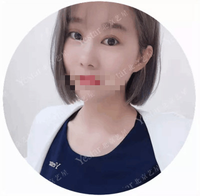 北京玻尿酸哪家医院好?变美不是靠运气