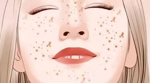 脸上的雀斑能不能去掉?北京哪家美容医院好