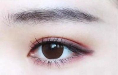 割双眼皮那里好? 双眼皮改变了我的颜值