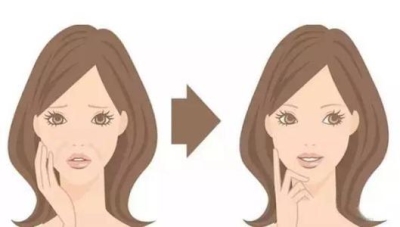 想去除皱纹变年轻,祛除皱纹价格多少