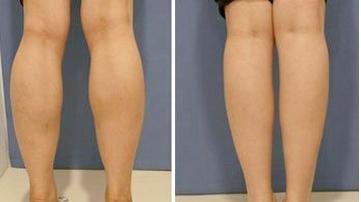 女生腿部肌肉发达怎样办?让你的健身效果翻倍