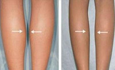 女生腿部肌肉发达怎样办?让你的健身效果翻倍